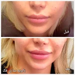 متخصص پوست مو زیبایی لیزر دکتر فرزانه علمشاهی