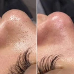 نمونه کار Medora clinic کلینیک زیبایی