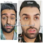 دکتر محمد امید بهترین دکتر زیبایی کانتور