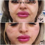 کلینیک زیبایی و لیزر مو گندم