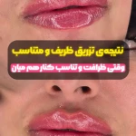 کلینیک زیبایی و لیزر موژان