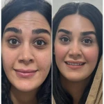 کلینیک زیبایی و لیزر مو گندم