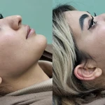 کلینیک زیبایی و لیزر سپیداسکین در تهران
