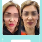 کلینیک پوست مو زیبایی آرا