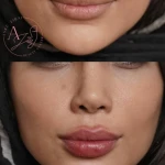 کلینیک پوست مو لیزر و لاغری عصر زیبایی