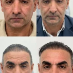 کلینیک زیبایی و لیزر ژاله