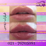 نمونه کار کلینیک پوست و مو نیک آفرید