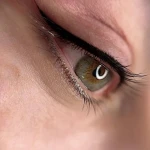 کاشت مژه و میکرو بلیدینگ رها