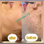 فشیال پاکسازی تخصصی ملکیا سلیمی