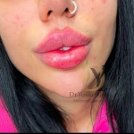 نمونه کار کلینیک زیبایی دکتر یوسف زادگان