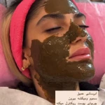 مرکز تخصصی پاکسازی پوست بنوشه