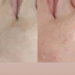 خدمات تخصصی پوست و مو مریم نصیرپور