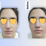 خدمات فیشال دیاموند وی کلاب