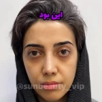 تصویر کلینیک لیزر لاغری فشیال پلاژن فیلربوتاکس