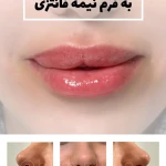 کلنیک پوست مو زیبای لیزر هیوا