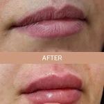 کلینیک زیبایی و لیزر مو دکتر سمانه وطن دوست