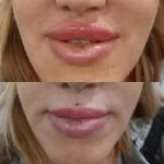 مطب پوست ،مو زیبایی دکتر فاطمه قره داغی