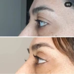 جراحی  زیبایی بینی  و صورت نئوفیس