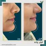  کلینیک پوست ، مو و لیزر نارینا