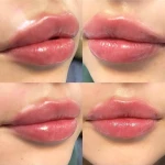 کلینیک پوست مو زیبایی و لیزر آیسل