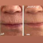 کلینیک تخصصی پوست دکتر مینا فتح آبادی