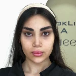 تصویر بیوتی لانژ عروس آرزو