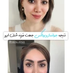 کلینیک تخصصی پوست و زیبایی ملینا