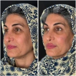 مطب زیبایی لیانارخ