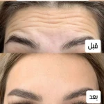 مرکز لیزر موهای زائد و پاکسازی پوست نوترسا