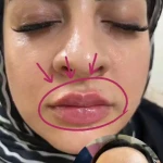 نمونه کار کلینیک پوست،مو و زیبایی دکتر محمد اسماعیلی