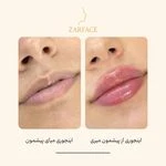 لوگوی کلینیک تزریق فیلر و بوتاکس زرفیس