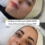 تصویر خدمات فیشال و پاکسازی پوست افروز