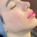 کلینیک پوست و زیبایی شایلی