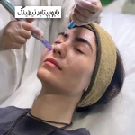  کلینیک لیزر ،ژل ،بوتاکس و لاغری ویتالایف