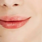 کلینیک زیبایی دکتر زرین بادینی