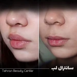 تصویر کلینیک زیبایی تهران بیوتی سنتر