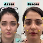 کلینیک زیبایی و لیزر ژاله