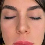 کلینیک زیبایی و لیزر لوسیفر