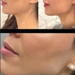 کلینیک زیبایی پارسیان آلفا