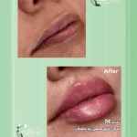 کلینیک زیبایی درموگه