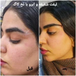 کلینیک زیبایی و لیزر مو گندم