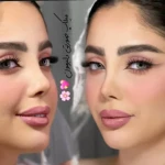 سالن زیبایی ایران درما