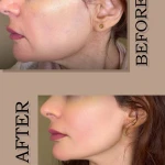 کلینیک زیبایی درناز (تخفیف ویژه لیزر)