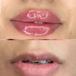 مرکز لیزر و کلینیک زیبایی سورا