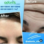 کلینیک پوست مو زیبایی و لیزر آدونیس