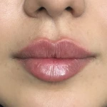 کلینیک زیبایی و لیزر دکتر حکیم پور