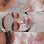 پاکسازی پوست آزیتا (هدیه مراجعه اول🎁)