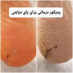 پدیکور و پودولوژیSD