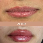 کلینیک زیبایی و لیزر مو دکتر سمانه وطن دوست
