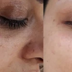 مرکز زیبایی و فیشال رویال رزا (استاد جلالی)